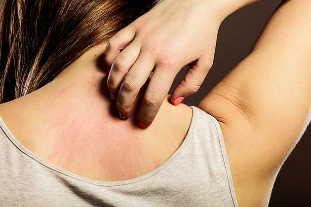 Itchy Skin